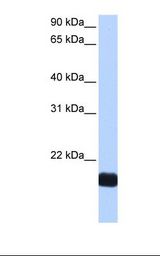 HEPG2 cell lysate. Antibody concentration: 0.5 ug/ml. Gel concentration: 12%.