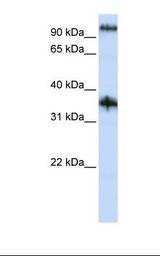 Jurkat cell lysate. Antibody concentration: 1.0 ug/ml. Gel concentration: 12%.