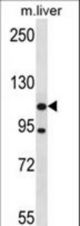 ADNP2 Antibody western blot of mouse liver tissue lysates (35 ug/lane). The ADNP2 antibody detected the ADNP2 protein (arrow).