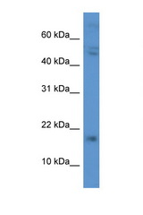 CGB / hCG Beta antibody LS-C135715 Western blot of 435S Cell lysate. Antibody concentration 1 ug/ml.