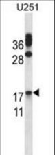 CGB/HCG-Beta Antibody western blot of U251 cell line lysates (35 ug/lane). The CGB/HCG-Beta antibody detected the CGB/HCG-Beta protein (arrow).