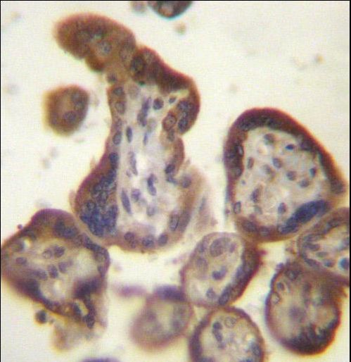 CGB/HCG-Beta Antibody immunohistochemistry of formalin-fixed and paraffin-embedded human placenta tissue followed by peroxidase-conjugated secondary antibody and DAB staining.
