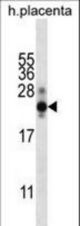 CGB/HCG-Beta Antibody western blot of human placenta tissue lysates (35 ug/lane). The CGB/HCG-Beta antibody detected the CGB/HCG-Beta protein (arrow).