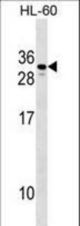CGB2 Antibody western blot of HL-60 cell line lysates (35 ug/lane). The CGB2 antibody detected the CGB2 protein (arrow).