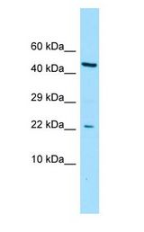 CGGBP1 antibody Western Blot of ACHN.