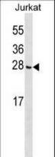 CGGBP1 Antibody western blot of Jurkat cell line lysates (35 ug/lane). The CGGBP1 Antibody detected the CGGBP1 protein (arrow).