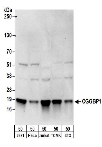 Detection of Human and Mouse CGGBP1 by Western Blot. Samples: Whole cell lysate (50 ug) from 293T, HeLa, Jurkat, mouse TCMK-1, and mouse NIH3T3 cells. Antibodies: Affinity purified rabbit anti-CGGBP1 antibody used for WB at 0.4 ug/ml. Detection: Chemiluminescence with an exposure time of 10 seconds.