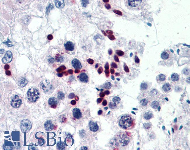 Anti-CGGBP1 antibody IHC of human testis. Immunohistochemistry of formalin-fixed, paraffin-embedded tissue after heat-induced antigen retrieval. Antibody LS-B4470 concentration 5 ug/ml.