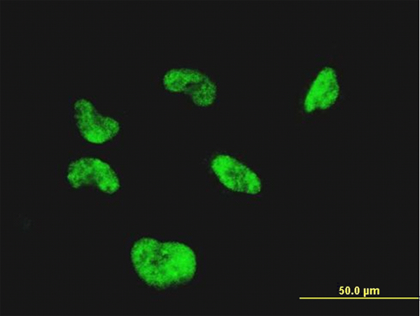 Immunofluorescence of monoclonal antibody to CGGBP1 on HeLa cell (antibody concentration 10 ug/ml).