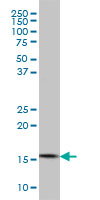CGGBP1 monoclonal antibody clone 1D11 Western blot of CGGBP1 expression in K-562.