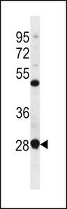 RRP7A Antibody western blot of CEM cell line lysates (35 ug/lane). The RRP7A antibody detected the RRP7A protein (arrow).