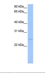 MCF7 cell lysate. Antibody concentration: 0.5 ug/ml. Gel concentration: 12%.