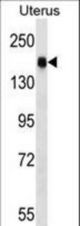 CGNL1 Antibody western blot of human normal Uterus tissue lysates (35 ug/lane). The CGNL1 antibody detected the CGNL1 protein (arrow).