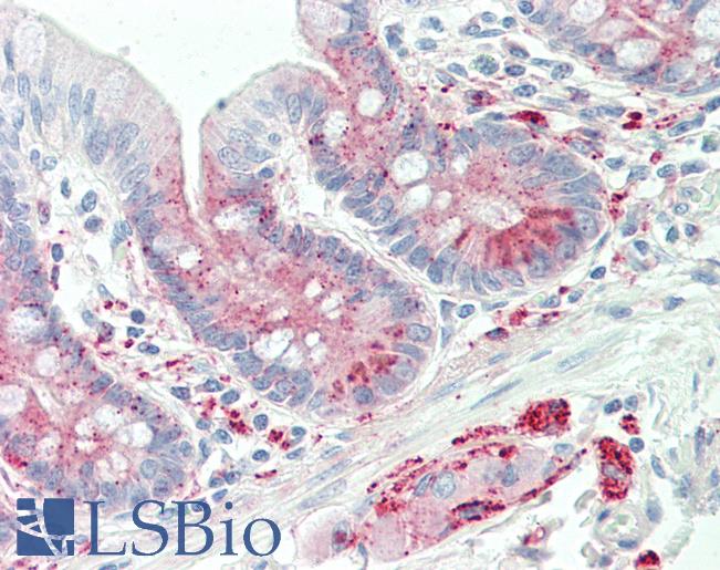 Anti-ADORA1 / Adenosine A1 Receptor antibody IHC staining of human small intestine. Immunohistochemistry of formalin-fixed, paraffin-embedded tissue after heat-induced antigen retrieval. Antibody LS-B10504 concentration 5 ug/ml.