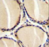 CALCA Antibody immunohistochemistry of formalin-fixed and paraffin-embedded human thyroid tissue followed by peroxidase-conjugated secondary antibody and DAB staining.