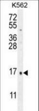 CALCA Antibody western blot of K562 cell line lysates (35 ug/lane). The CALCA antibody detected the CALCA protein (arrow).