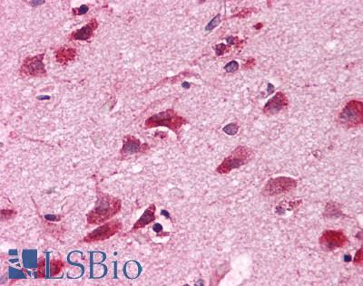 Anti-Adenosine A1 Receptor antibody LS-A10 IHC of human brain, neurons and glia. Immunohistochemistry of formalin-fixed, paraffin-embedded tissue after heat-induced antigen retrieval.