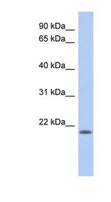 CHAC2 antibody LS-C111831 Western blot of Placenta lysate.