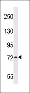 CHADL Antibody western blot of T47D cell line lysates (35 ug/lane). The CHADL antibody detected the CHADL protein (arrow).