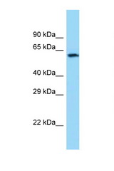CHAT antibody LS-C146075 Western blot of Fetal Brain lysate. Antibody concentration 1 ug/ml.