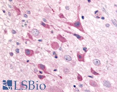 Anti-Adenosine A1 Receptor antibody LS-A9 IHC of rat brain, neurons. Immunohistochemistry of formalin-fixed, paraffin-embedded tissue after heat-induced antigen retrieval.