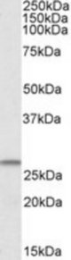 CHCHD3 antibody (1 ug/ml) staining of Human Heart lysate (35 ug protein/ml in RIPA buffer). Primary incubation was 1 hour. Detected by chemiluminescence.
