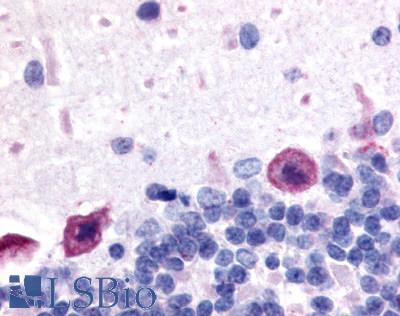 Anti-Adenosine A1 Receptor antibody LS-A11 IHC of rat brain, Purkinje neurons. Immunohistochemistry of formalin-fixed, paraffin-embedded tissue after heat-induced antigen retrieval.
