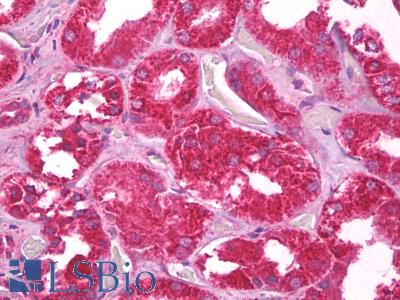 Anti-CHCHD3 antibody IHC of human kidney. Immunohistochemistry of formalin-fixed, paraffin-embedded tissue after heat-induced antigen retrieval. Antibody LS-B6861 concentration 5 ug/ml.