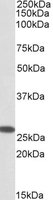 CHCHD3 antibody (0.3 ug/ml) staining of Human Placenta lysate (35 ug protein/ml in RIPA buffer). Primary incubation was 1 hour. Detected by chemiluminescence.