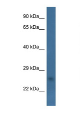 CHCHD6 antibody LS-C135505 Western blot of Fetal Heart lysate. Antibody concentration 1 ug/ml.