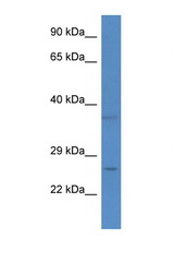 CHCHD6 antibody LS-C135504 Western blot of Fetal Liver lysate. Antibody concentration 1 ug/ml.