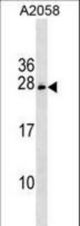 CHCHD6 Antibody western blot of A2058 cell line lysates (35 ug/lane). The CHCHD6 antibody detected the CHCHD6 protein (arrow).