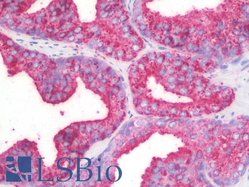Anti-CHCHD6 antibody IHC staining of human prostate. Immunohistochemistry of formalin-fixed, paraffin-embedded tissue after heat-induced antigen retrieval. Antibody LS-B10062 concentration 10 ug/ml.