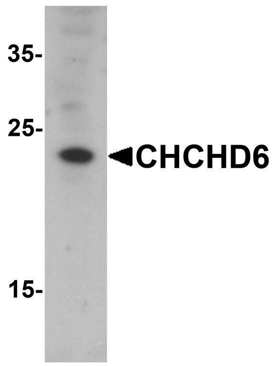 Western blot analysis of CHCHD6 in SK-N-SH cell lysate with CHCHD6 antibody at 1 ug/ml.