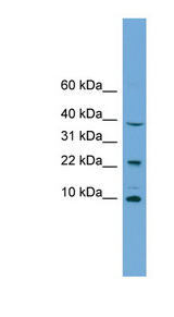 CHCHD8 antibody LS-C135416 Western blot of Jurkat lysate.