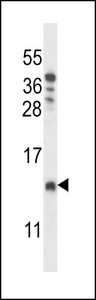 CHCH8 Antibody western blot of T47D cell line lysates (35 ug/lane). The CHCH8 antibody detected the CHCH8 protein (arrow).