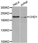 Western blot analysis of extracts of various cell lines, using CHD1 antibody.