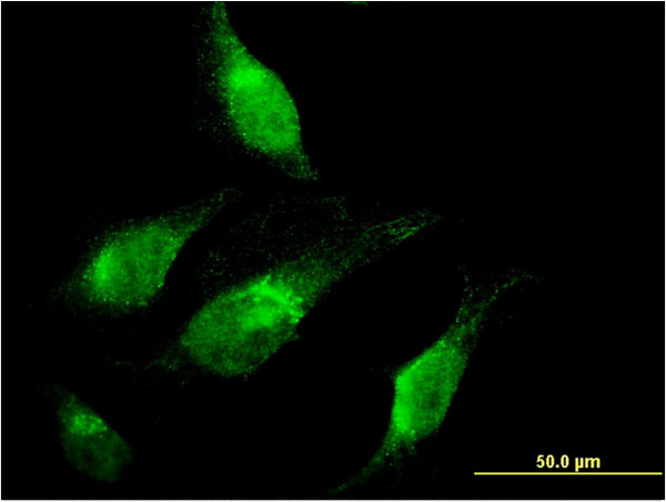 Immunofluorescence of monoclonal antibody to CHD1 on HeLa cell . [antibody concentration 10 ug/ml]