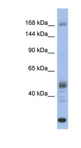 CHD1 antibody LS-C109901 Western blot of Fetal Stomach lysate.