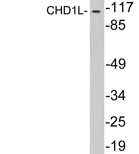 Western blot of extracts from HepG2 cells, using CHD1L antibody.