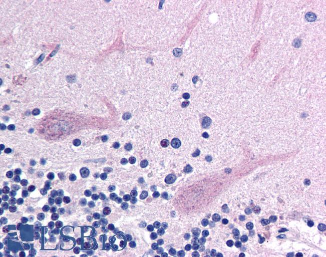 Anti-CHD4 antibody IHC of human brain, cerebellum. Immunohistochemistry of formalin-fixed, paraffin-embedded tissue after heat-induced antigen retrieval. Antibody LS-B204 concentration 20 ug/ml.