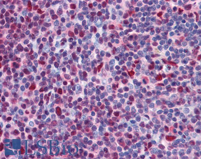 Anti-CHD4 antibody IHC of human tonsil. Immunohistochemistry of formalin-fixed, paraffin-embedded tissue after heat-induced antigen retrieval. Antibody LS-B5605 concentration 5 ug/ml.