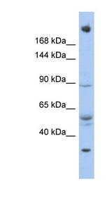 CHD4 antibody LS-B5605 Western blot of OVCAR-3 cell lysate.
