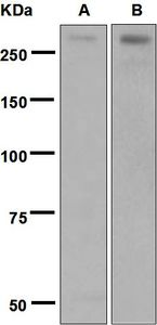 Western blot analysis on (A) human adrenal gland and (B) SH-SY5Y cell lysates using anti-CHD5 antibody.