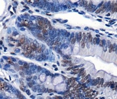 Immunohistochemistry: Chd7 Antibody - IHC of CHD7 in mouse intestine using DAB with hematoxylin counterstain.