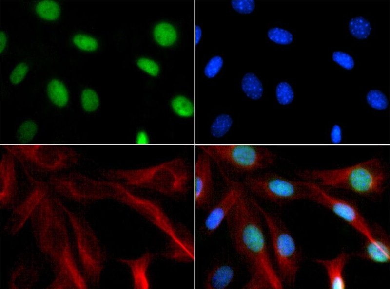 Immunocytochemistry/Immunofluorescence: Chd7 Antibody - Antibody was tested in NIH/3T3 cells with FITC (green). Nuclei and actin were counterstained with Dapi (blue) and Phalloidin (red).