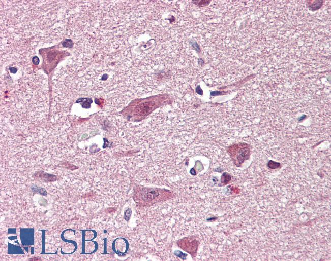 Anti-CHD7 antibody IHC of human brain, cortex. Immunohistochemistry of formalin-fixed, paraffin-embedded tissue after heat-induced antigen retrieval. Antibody LS-B7356 concentration 3.75 ug/ml.