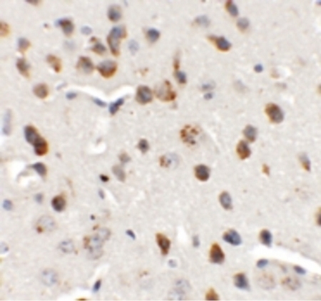 Immunohistochemistry of CHD7 in mouse brain tissue with CHD7 antibody at 5 ug/ml.