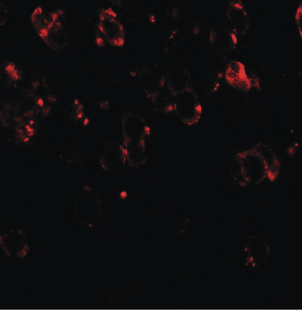 Immunofluorescence of CHD7 in mouse brain tissue with CHD7 antibody at 20 ug/ml.