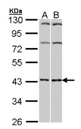 Sample (30 ug of whole cell lysate). A: Hela, B: Molt-4 . 10% SDS PAGE. A2a Receptor / ADORA2A antibody diluted at 1:1000.